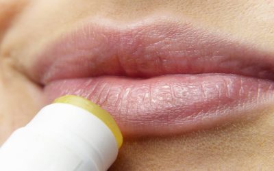 Herpes e sole: alcuni consiglie rimedi utili